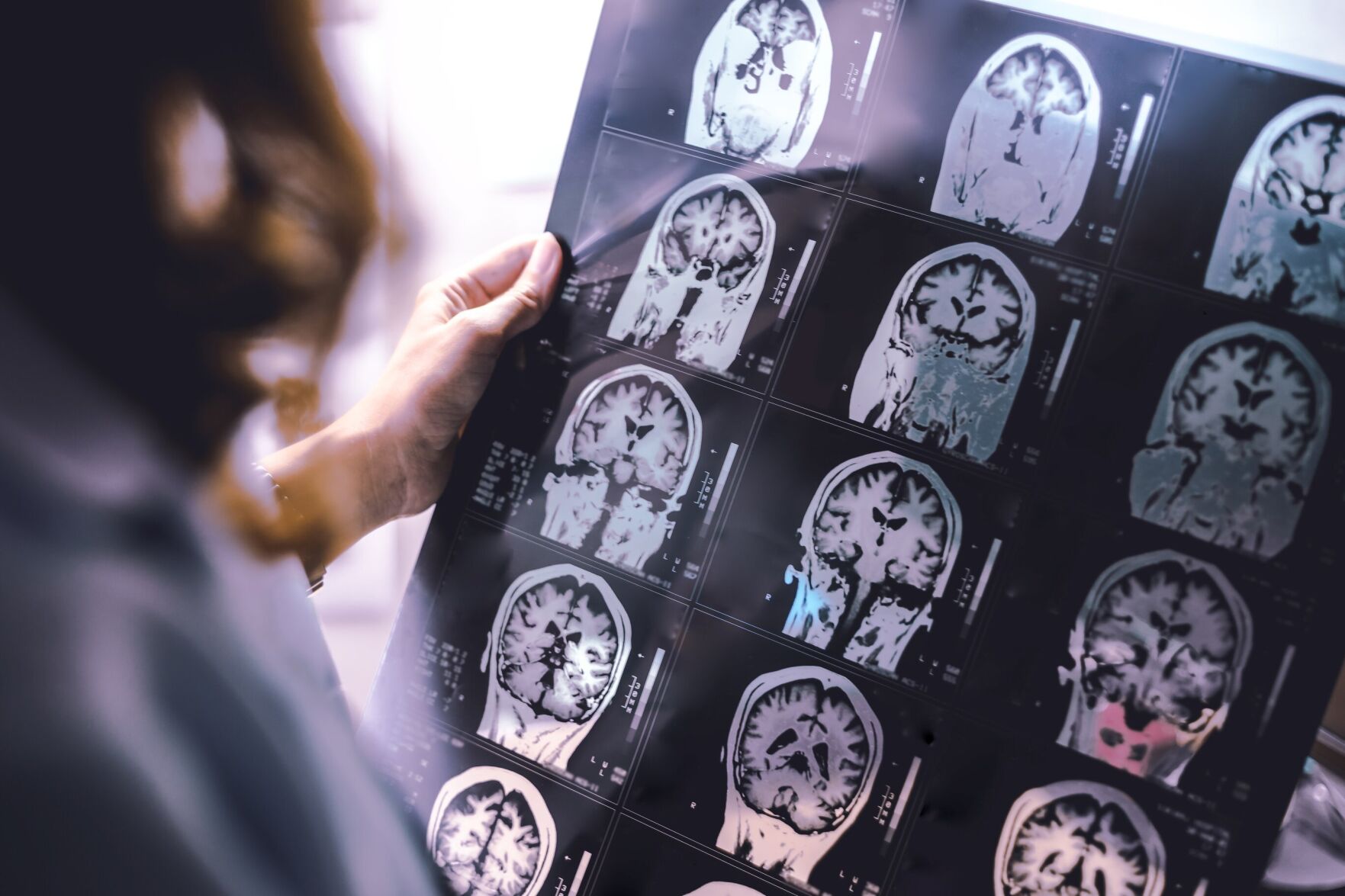 Brain scan.jpg